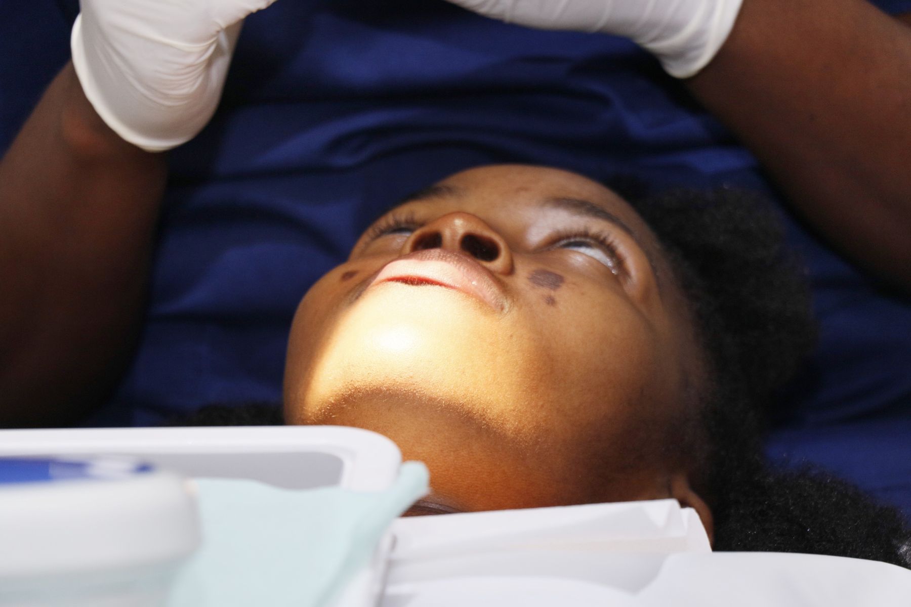 Adult orthodontic treatment